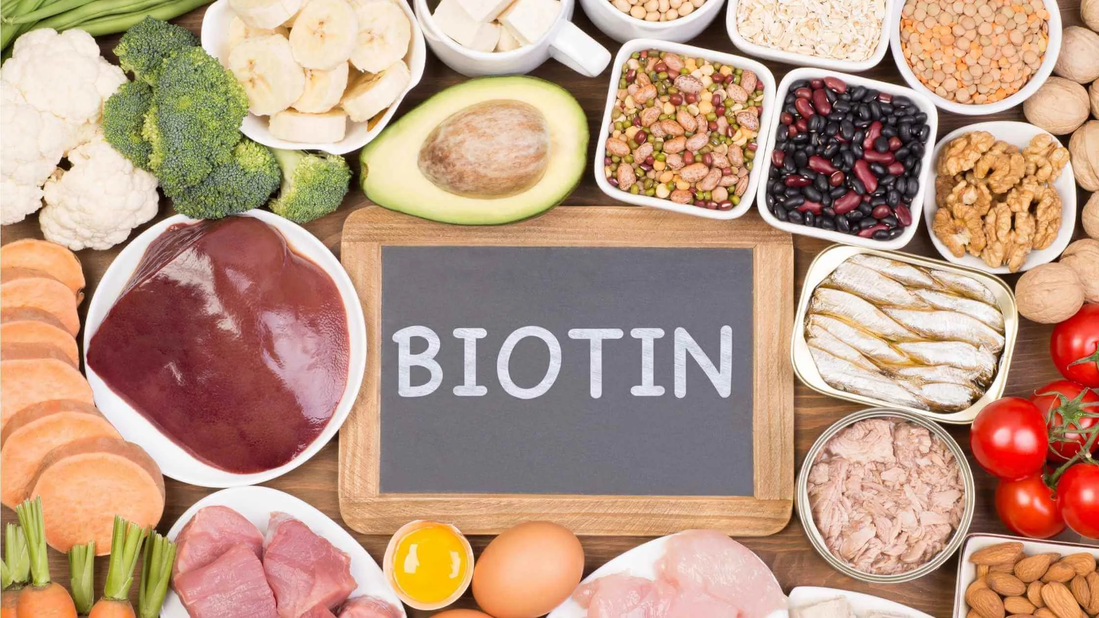 IS BIOTIN A HAIRFALL EXPERT? – MAJOR BIOTIN BENEFITS FOR HAIR 2021