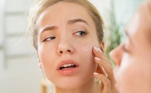 5 Tips to Prevent Dry Winter Skin