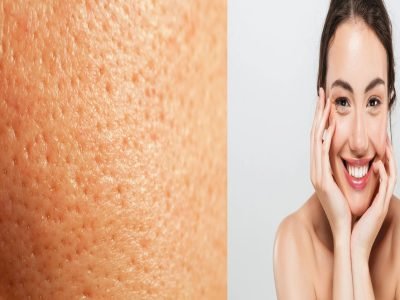 Minimize Facial Pores: 5 Tips to Hide Open Pores with Makeup