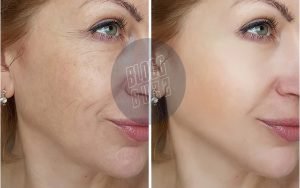 11 ways to reduce premature skin aging