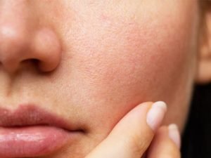 Minimize Facial Pores: 5 Tips to Hide Open Pores with Makeup