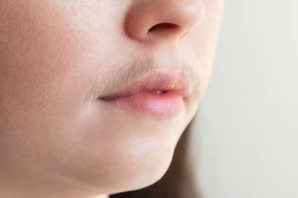 Facial hair