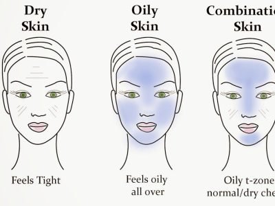 5 DIFFERENT SKIN TYPES | BEST SKINCARE TIPS